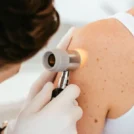skin-test